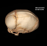 skull image top