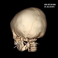 skull image back